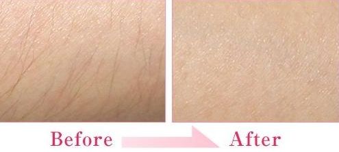 蘇州有哪些可以去疤痕的醫(yī)院？