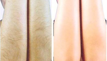 南充整形好醫(yī)院是哪家？專家點評南充地區(qū)整形美容醫(yī)院排名