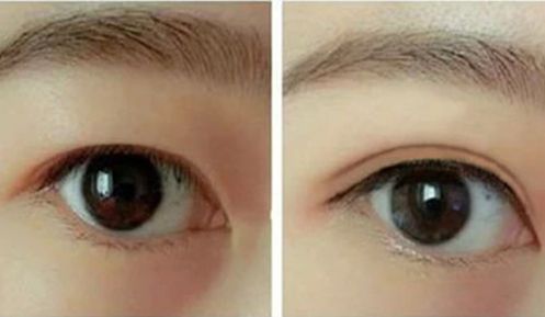 蚌埠去胎記哪家醫(yī)院好？專業(yè)醫(yī)生推薦蚌埠市頂級醫(yī)療機構(gòu)排行榜