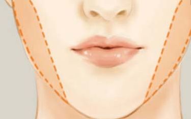 疤痕增生治療效果比較好的整形醫(yī)院推薦TOP8