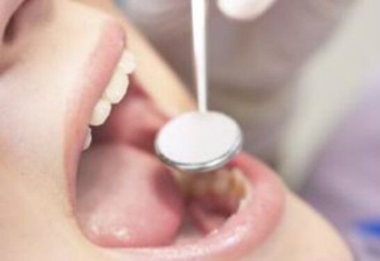 2023年青島祛口周紋手術(shù)醫(yī)院綜合TOP10排行，經(jīng)驗(yàn)豐富的醫(yī)院大揭秘！