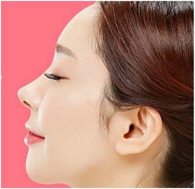 激光脫腋毛有哪些優(yōu)點好處？夜來香和脫腋毛有關(guān)系嗎？