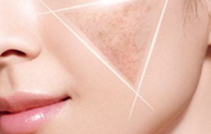 揭秘：過去的港風(fēng)美人整容了嗎？深入探討翻拍劇中的美貌之謎