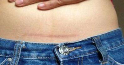 注射瘦臉和瘦腿真的有效嗎？持續(xù)效果能維持多久？