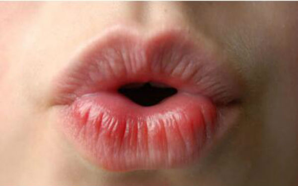 昆明肉毒素注射哪里好？2023年昆明整形醫(yī)院進(jìn)口肉毒素排行TOP10出爐！