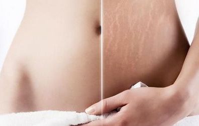 南寧做鼻子哪家整形醫(yī)院好？權(quán)威測評告訴你最靠譜的選擇