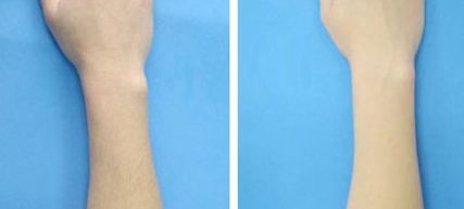 全國著名植發(fā)機構(gòu)集錦：北京、蘇州、成都三家翹楚