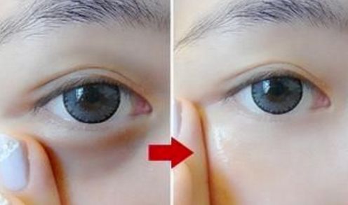 上海哪家醫(yī)院的雙眼手術(shù)效果最好呢？