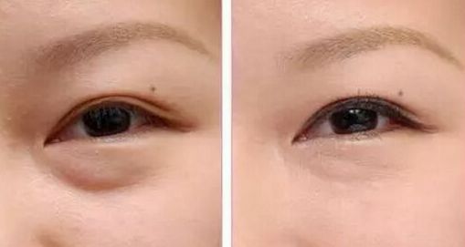 柳州市哪家醫(yī)院祛斑效果好？柳州市民推薦的專業(yè)祛斑醫(yī)院大揭秘！