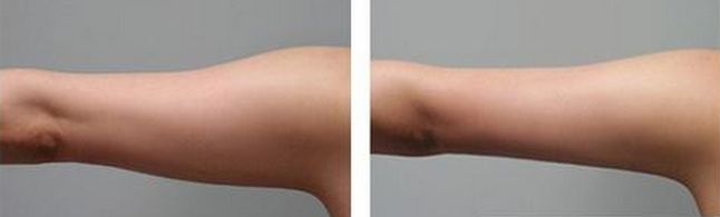 衡水外科醫(yī)院排名怎么樣？哪家醫(yī)院口碑更好？