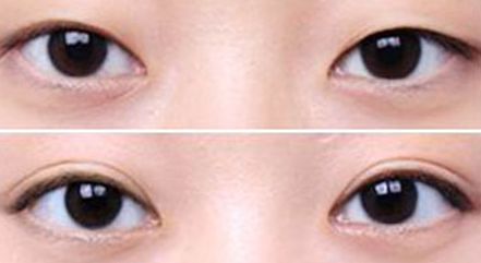 【2023年蘇州哪家醫(yī)療整形醫(yī)院口碑最佳】