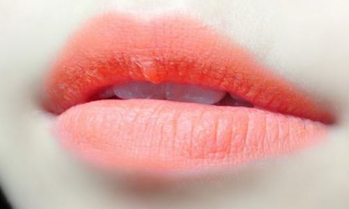 整容需求不斷增長(zhǎng)，導(dǎo)致人們?cè)絹?lái)越多地追求美麗外貌