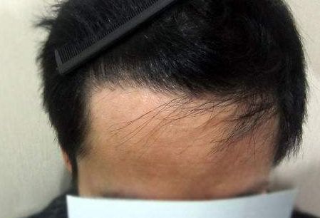 全國(guó)更受推崇的整形鼻子專(zhuān)家名單揭曉！鼻王大咖集結(jié)，醫(yī)術(shù)無(wú)與倫比！