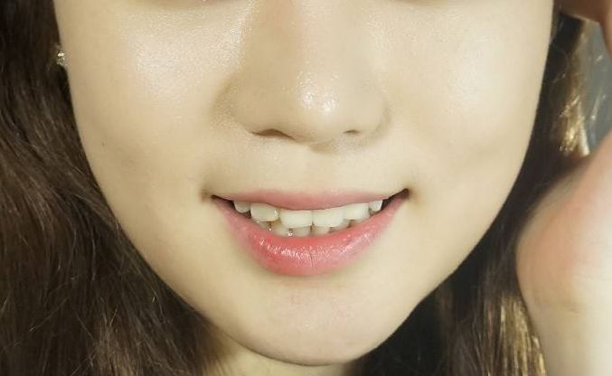 廣州皮膚美容哪家好？熱門平臺大比拼！