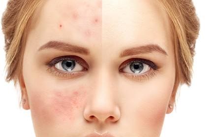 濟(jì)南胸產(chǎn)科哪家醫(yī)院好？完整評(píng)測(cè)指南，盡在這里！