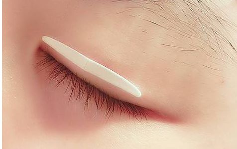 明星Monica進(jìn)行了整容手術(shù)？