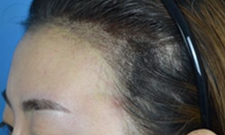 平頂山哪家整形醫(yī)院好？挑選合適的整形醫(yī)院必備的幾點(diǎn)參考