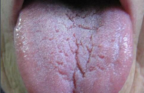 2023鄭州哪家整形醫(yī)院最適合抽脂提臀？排行榜前十值得收藏！