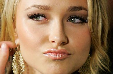 深圳自體脂肪耳垂豐益處與技術(shù)解析