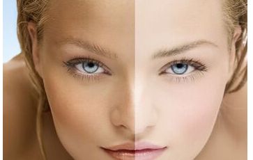 昆山看痘痘醫(yī)院哪家好？揭秘昆山市最受用戶信賴的痘痘醫(yī)院排名