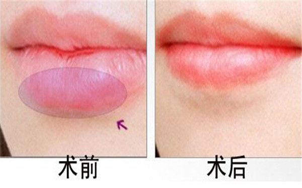 2023寧波彩光嫩膚去黑眼圈醫(yī)院前10排行大揭秘！尋找神效的彩光嫩膚醫(yī)療美容機構