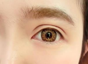 青島哪家醫(yī)院祛除眼角紋好？2023青島祛除眼角紋醫(yī)院排名揭曉！