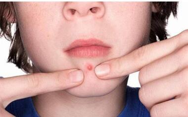 北大口腔正畸效果如何？牙齒矯正8個月有哪些親身經(jīng)歷？