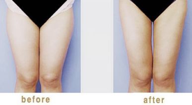 金華哪家醫(yī)院打瘦臉針好？專(zhuān)家解析金華市最受歡迎的瘦臉針醫(yī)院