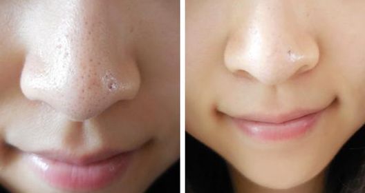 杭州注射瘦腿針哪家醫(yī)院好？杭州市排名前列的注射瘦腿針醫(yī)院推薦！