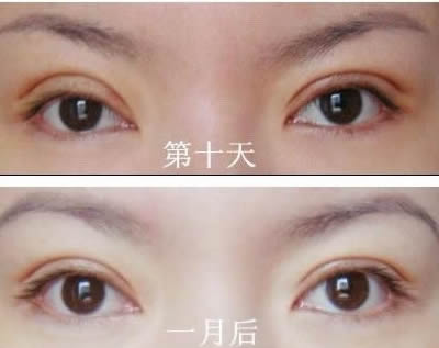 嘉興推薦的前10家拉皮除皺美容醫(yī)院排名大揭秘！