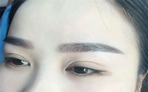 菜花耳矯正手術(shù)有可能帶來風(fēng)險嗎？菜花耳矯正手術(shù)的原理和風(fēng)險了解一下