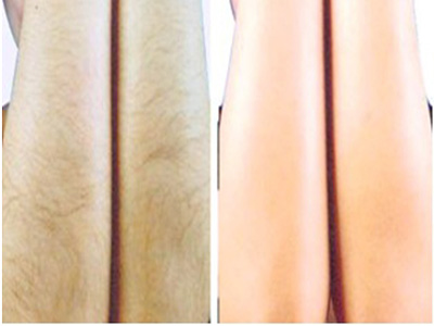 2023廣州面部填充自體脂肪醫(yī)院排行榜TOP10，高經(jīng)驗(yàn)專家推薦！