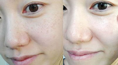 泉州整形手術(shù)，哪家醫(yī)院好？綜合排名及用戶口碑調(diào)查