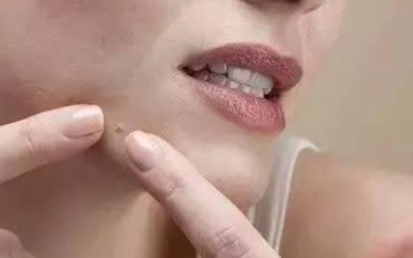 文夢(mèng)洋整容后臉部發(fā)生什么變化？她的面容為何變得如此僵硬？