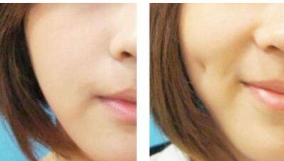 單眼皮女生真的好看嗎？這種特點(diǎn)竟然可以這么可愛！