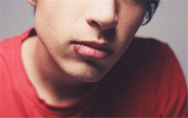 沈陽大麥微針植發(fā)醫(yī)院值得信賴嗎？植發(fā)效果好嗎？