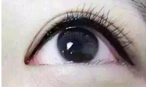 南昌祛斑醫(yī)院推薦：瑕疵拜拜，迎來無瑕肌