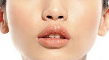 寧波打肉毒素哪家醫(yī)院好？綜合評測幫你選擇最適合的醫(yī)院！