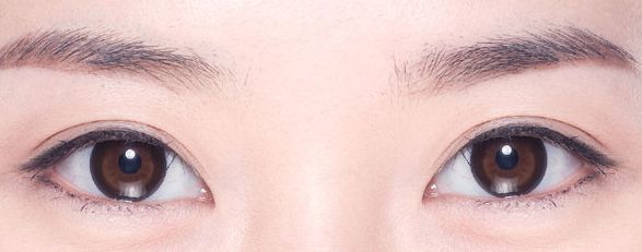 上海祛眼袋的醫(yī)院排名及專家推薦，哪家醫(yī)院靠譜？