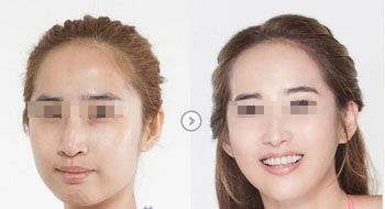 具惠善為何未能成功減肥？她不慎“品嘗”狗糧后效果減退？