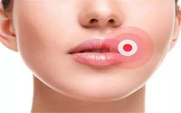 珠?？泼勒吾t(yī)院割雙眼皮哪位醫(yī)生技術(shù)高超？無效果的風(fēng)險(xiǎn)高嗎？