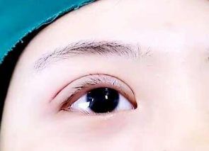 李健美貌大變身！整容傳聞真相揭秘