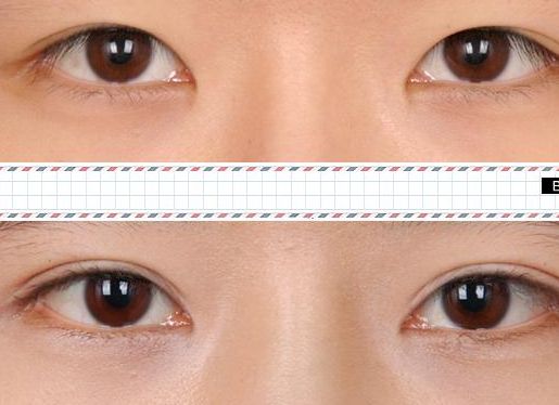 青島祛紅痘印整形美容醫(yī)院推薦：前十名榜單公開(kāi)