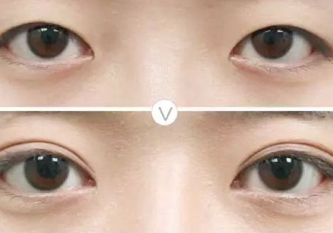 哈爾濱豐胸手術(shù)信息大揭秘！藝星、伊美爾、哈醫(yī)大二院等TOP5值得關(guān)注！