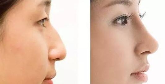 上海看手臂治療?？漆t(yī)院有哪些？