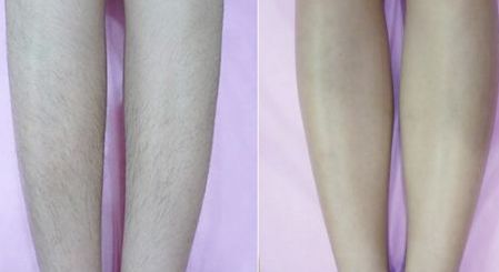 唐山整形美容醫(yī)院排名專業(yè)評測，哪家整形醫(yī)院口碑好？