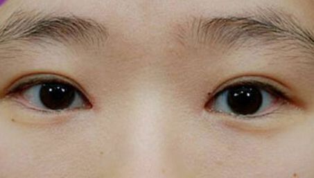 揭秘深圳整形美容行業(yè)精選醫(yī)院名單，輕松解決選擇困擾！