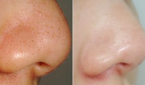 南京打瘦臉針效果好的醫(yī)院有哪些？