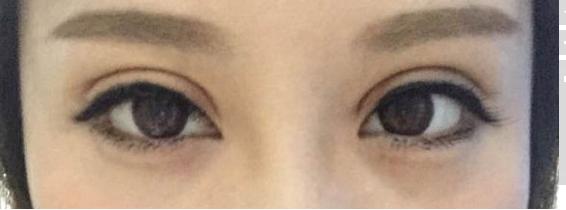 長沙臻顏整形醫(yī)院門診部醫(yī)院服務(wù)、技術(shù)盤點：專業(yè)醫(yī)美整形門診服務(wù)是否令人滿意？技術(shù)水平是否值得信賴？