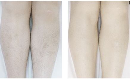 鄭州鼻綜合整形醫(yī)院哪家好？專家為您推薦頂級(jí)整形醫(yī)院